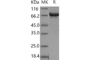 Western Blotting (WB) image for Prolyl Endopeptidase (PREP) protein (His tag) (ABIN7197520) (PREP Protein (His tag))
