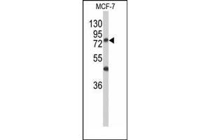 Western blot analysis of GALNT3 Antibody (Center) in MCF-7 cell line lysates (35ug/lane).