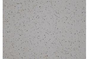 ABIN6275887 at 1/100 staining Human heart tissue by IHC-P. (LHX1 antibody  (Internal Region))