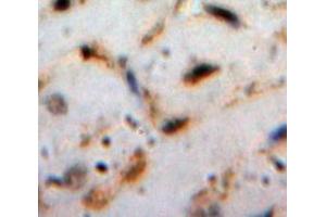 Used in DAB staining on fromalin fixed paraffin-embedded Heart tissue (Cardiotrophin 1 antibody  (AA 1-201))