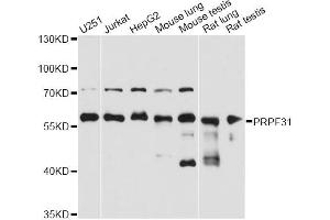 Western blot analysis of extracts of various cell lines, using PRPF31 antibody (ABIN2564749) at 1:3000 dilution. (PRPF31 antibody)