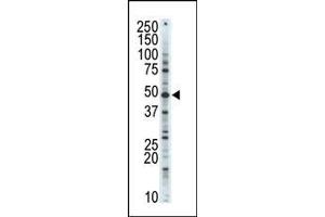 Western blot analysis of anti-CDK10 Pab in A375 cell lysate. (CDK10 antibody  (N-Term))