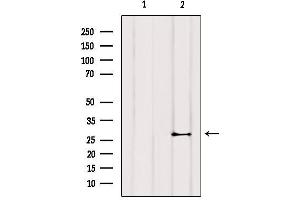 Western blot analysis of extracts from COS-7, using TNNI3 Antibody.