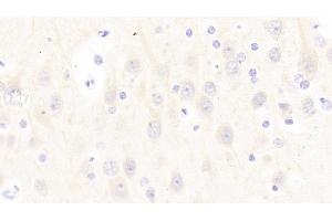 Detection of PCT in Human Cerebrum Tissue using Polyclonal Antibody to Procalcitonin (PCT) (Procalcitonin antibody  (AA 26-141))