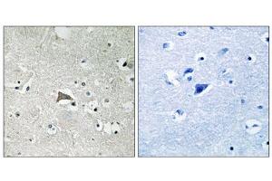 Immunohistochemistry analysis of paraffin-embedded human brain tissue, using VEGFR1 antibody. (FLT1 antibody  (Tyr1048))