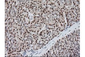 Image no. 4 for anti-Malignant T Cell Amplified Sequence 1 (MCTS1) (AA 1-181) antibody (ABIN1490598)