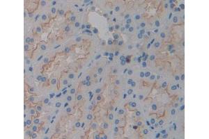 Used in DAB staining on fromalin fixed paraffin- embedded kidney tissue (TGOLN2 antibody  (AA 22-323))