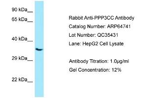 Western Blotting (WB) image for anti-Protein Phosphatase 3, Catalytic Subunit, gamma Isozyme (PPP3CC) (C-Term) antibody (ABIN971457) (PPP3CC antibody  (C-Term))