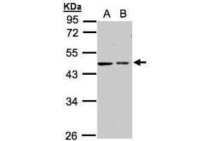 WB Image Sample(30 ug whole cell lysate) A:A431, B:Hep G2 , 10% SDS PAGE antibody diluted at 1:1000 (GALK2 antibody)
