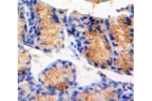 Used in DAB staining on fromalin fixed paraffin-embedded Bowels tissue (MAP4K5 antibody  (AA 9-231))