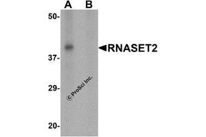 Western Blotting (WB) image for anti-Ribonuclease T2 (RNASET2) (C-Term) antibody (ABIN1030623) (RNASET2 antibody  (C-Term))