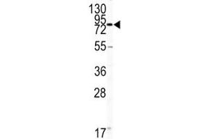 Western Blotting (WB) image for anti-Platelet/endothelial Cell Adhesion Molecule (PECAM1) (AA 690-718) antibody (ABIN3028932)