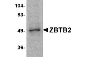 Western Blotting (WB) image for anti-Zinc Finger and BTB Domain Containing 2 (ZBTB2) (Middle Region) antibody (ABIN1031170)