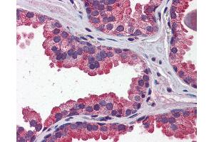Anti-WNT3A antibody IHC of human prostate.