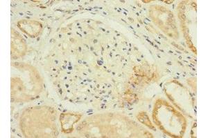 Immunohistochemistry of paraffin-embedded human kidney tissue using ABIN7175612 at dilution of 1:100 (CACNA1H antibody  (AA 260-360))