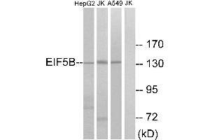 Western blot analysis of extracts from HepG2 cells, Jurkat cells and A549 cells, using EIF5B antibody.