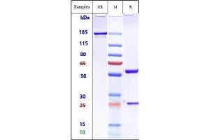 Anti-TM4SF1 Reference Antibody (Beth Israel Patent Anti-TM4SF1) on SDS-PAGE under reducing (R) condition.
