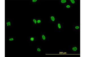 Image no. 3 for anti-RNA Binding Motif Protein, X-Linked-Like 2 (RBMXL2) (AA 1-91) antibody (ABIN599219) (RBMXL2 antibody  (AA 1-91))