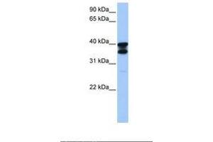 Image no. 1 for anti-Solute Carrier Family 25 (Mitochondrial Carrier, Adenine Nucleotide Translocator), Member 31 (SLC25A31) (AA 25-74) antibody (ABIN6738911) (SLC25A31 antibody  (AA 25-74))