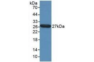Detection of Recombinant TPT1, Human using Polyclonal Antibody to Tumor Protein, Translationally Controlled 1 (TPT1) (TPT1 antibody  (AA 1-172))