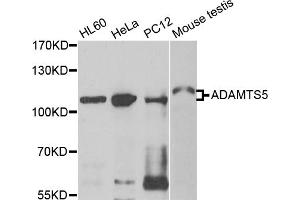 Western blot analysis of extracts of various cell lines, using ADAMTS5 antibody (ABIN5975868) at 1/500 dilution. (ADAMTS5 antibody)