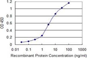 Detection limit for recombinant GST tagged SNAP25 is 0. (SNAP25 antibody  (AA 31-130))