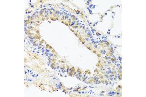 Immunohistochemistry of paraffin-embedded mouse lung using BGLAP antibody at dilution of 1:100 (x40 lens).