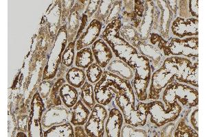 ABIN6279105 at 1/100 staining Mouse kidney tissue by IHC-P. (GALM antibody  (C-Term))