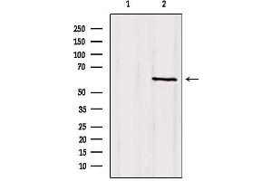 Western blot analysis of extracts from mouse brain, using CLIP3 Antibody.