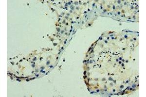 Immunohistochemistry of paraffin-embedded human testis tissue using ABIN7169136 at dilution of 1:100 (PAK6 antibody  (AA 1-270))