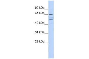 WB Suggested Anti-ZNF415 Antibody Titration:  0. (ZNF415 antibody  (N-Term))
