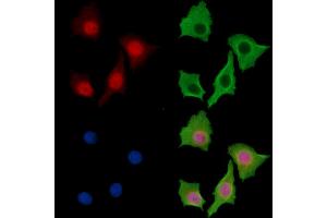 anti-Chromosome 1 Open Reading Frame 86 (C1ORF86) antibody