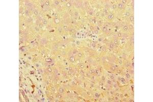 Immunohistochemistry of paraffin-embedded human liver tissue using ABIN7171544 at dilution of 1:100 (TAS2R38 antibody  (AA 212-251))