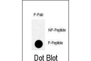 Dot blot analysis of anti-Phospho-Rad9- Antibody (ABIN389633 and ABIN2839629) on nitrocellulose membrane. (RAD9A antibody  (pSer328))