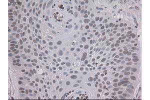 Immunohistochemical staining of paraffin-embedded colon using anti-STAT3 (ABIN2452542) mouse monoclonal antibody. (STAT3 antibody  (AA 154-175))