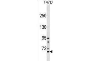 Western Blotting (WB) image for anti-Rhophilin, rho GTPase Binding Protein 2 (RHPN2) antibody (ABIN3000839) (RHPN2 antibody)