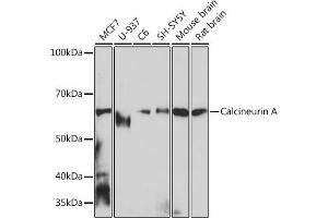 Western blot analysis of extracts of various cell lines, using Calcineurin A Rabbit mAb (ABIN7269692) at 1:1000 dilution. (PPP3CA antibody)