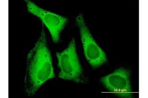 Immunofluorescence of purified MaxPab antibody to EIF5B on HeLa cell.