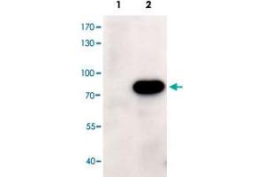 HEK293 overexpressing human ABCD1 and probed with ABCD1 polyclonal antibody  at 1ug/ml (mock transfection in first lane). (ABCD1 antibody)