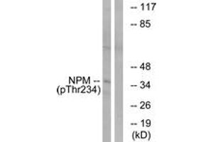Western blot analysis of extracts from HeLa cells treated with nocodazole 1ug/ml 18h, using NPM (Phospho-Thr234) Antibody. (NPM1 antibody  (pThr234))