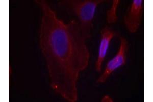Immunofluorescence staining of methanol-fixed Hela cells using PLCg2(Phospho-Tyr753) Antibody. (Phospholipase C gamma 2 antibody  (pTyr753))