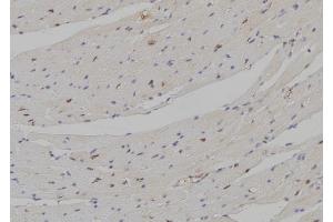 ABIN6274297 at 1/100 staining Mouse heart tissue by IHC-P. (DLX5 antibody  (Internal Region))