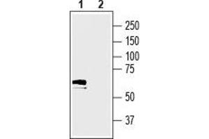 Western Blotting (WB) image for anti-Solute Carrier Family 17 (Acidic Sugar Transporter), Member 5 (SLC17A5) (AA 479-492), (Intracellular) antibody (ABIN7043679)