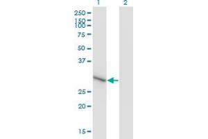 Western Blot analysis of ZNF483 expression in transfected 293T cell line by ZNF483 monoclonal antibody (M01), clone 1E7. (ZNF483 antibody  (AA 142-230))