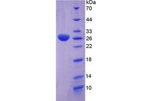 SDS-PAGE of Protein Standard from the Kit (Highly purified E. (Clusterin ELISA Kit)