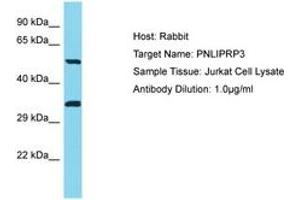 Image no. 1 for anti-Pancreatic Lipase-Related Protein 3 (PNLIPRP3) (AA 389-438) antibody (ABIN6750748) (PNLIPRP3 antibody  (AA 389-438))