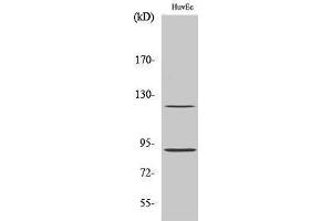 Western Blotting (WB) image for anti-PR (pSer190) antibody (ABIN3172967) (PR (pSer190) antibody)
