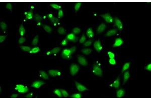 Immunofluorescence analysis of HeLa cells using C1S Polyclonal Antibody (C1S antibody)