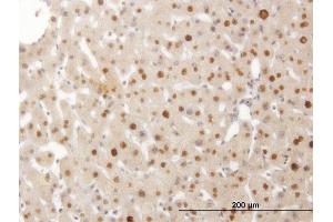 Immunoperoxidase of monoclonal antibody to SMAD6 on formalin-fixed paraffin-embedded human liver. (SMAD6 antibody  (AA 285-384))