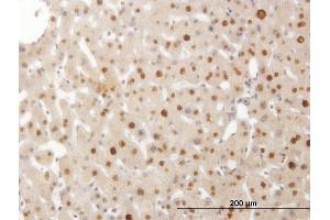 Immunoperoxidase of monoclonal antibody to SMAD6 on formalin-fixed paraffin-embedded human liver. (SMAD6 antibody  (AA 285-384))